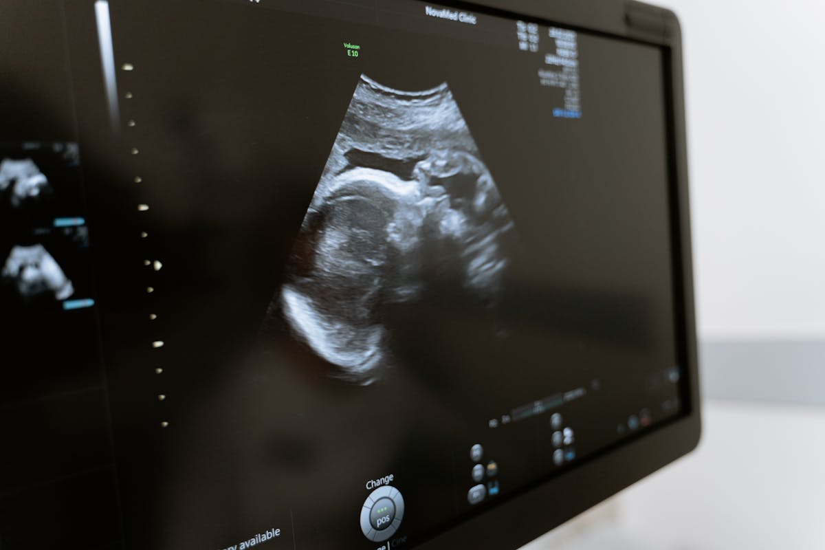 Fetal medicine ultrasound